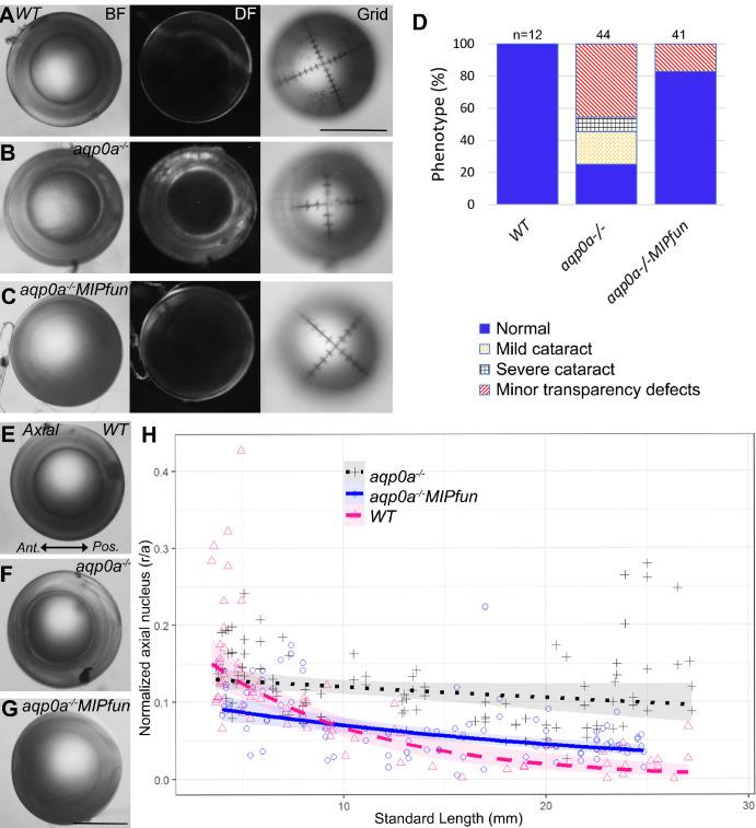 https://cdn.ncbi.nlm.nih.gov/pmc/blobs/8856/11437712/08d69a08f5a3/iovs-65-11-42-f002.jpg