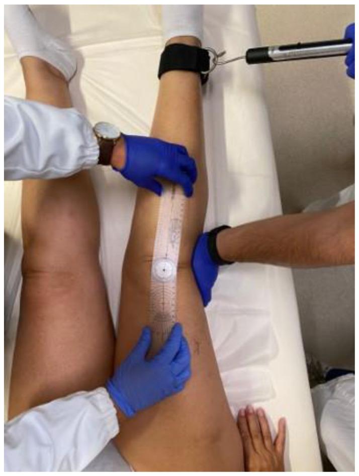 https://cdn.ncbi.nlm.nih.gov/pmc/blobs/885b/10532354/f21f9225d6bf/jcm-12-06007-g001.jpg