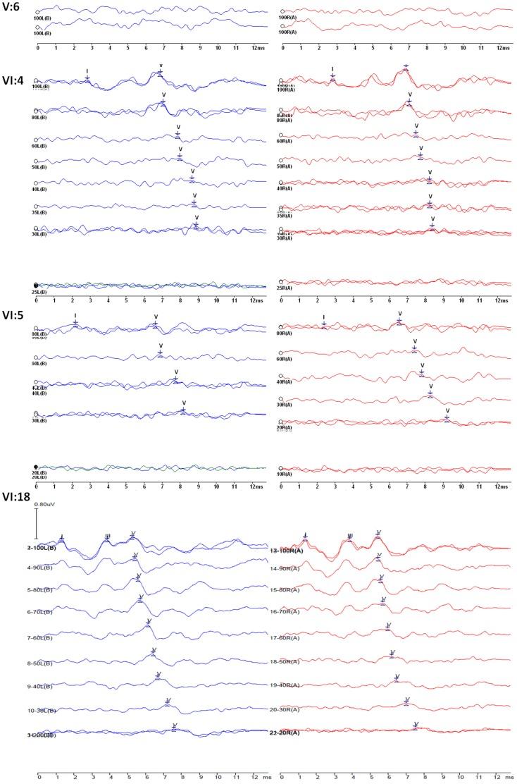 https://cdn.ncbi.nlm.nih.gov/pmc/blobs/885b/4020765/b1bdbe19a2cf/pone.0097064.g003.jpg