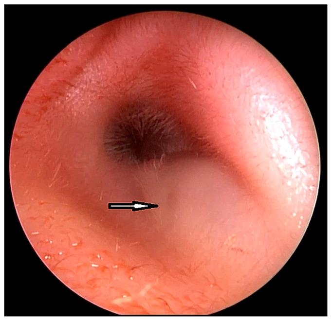 https://cdn.ncbi.nlm.nih.gov/pmc/blobs/8864/10377891/d289f499ef98/children-10-01158-g001.jpg