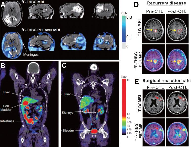https://cdn.ncbi.nlm.nih.gov/pmc/blobs/886a/8171102/6beb9925be3d/thnov11p6800g003.jpg