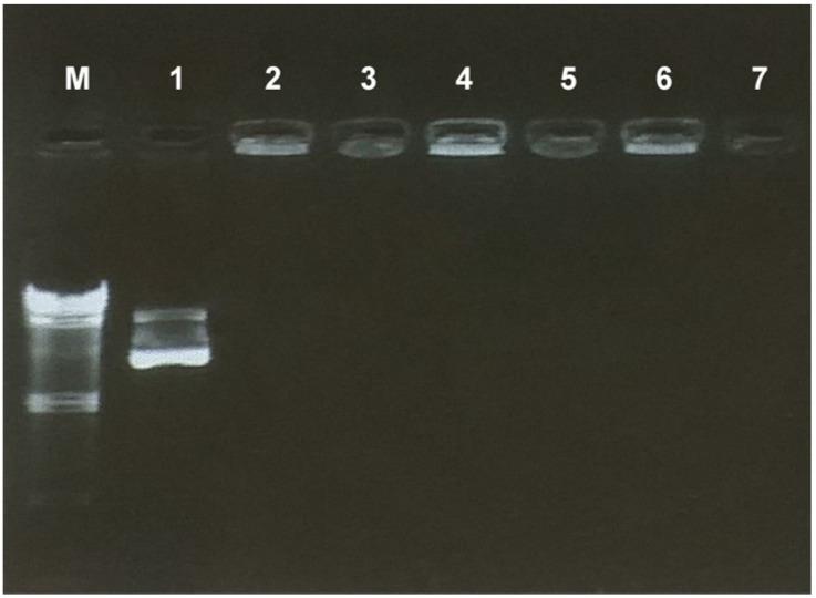 https://cdn.ncbi.nlm.nih.gov/pmc/blobs/886b/10378784/d7dbaa9a9ff7/gels-09-00541-g001.jpg