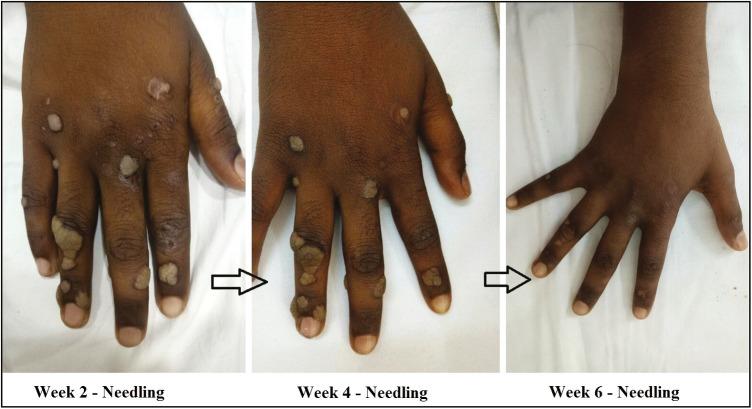 https://cdn.ncbi.nlm.nih.gov/pmc/blobs/886c/7646425/0b7aaa9bf3b1/JCAS-13-217-g002.jpg