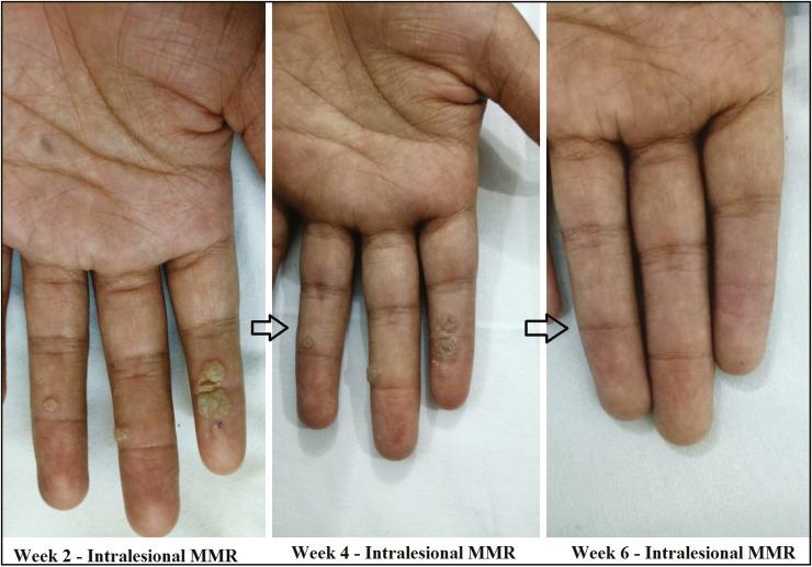 https://cdn.ncbi.nlm.nih.gov/pmc/blobs/886c/7646425/36e3ce421f89/JCAS-13-217-g004.jpg