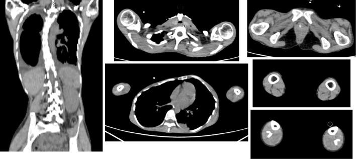 https://cdn.ncbi.nlm.nih.gov/pmc/blobs/8871/9259818/7ac5b4ae558f/1349-7235-61-1897-g001.jpg