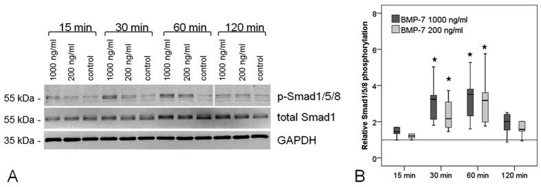 https://cdn.ncbi.nlm.nih.gov/pmc/blobs/8875/4942578/fcf52aad67f6/srep29703-f3.jpg