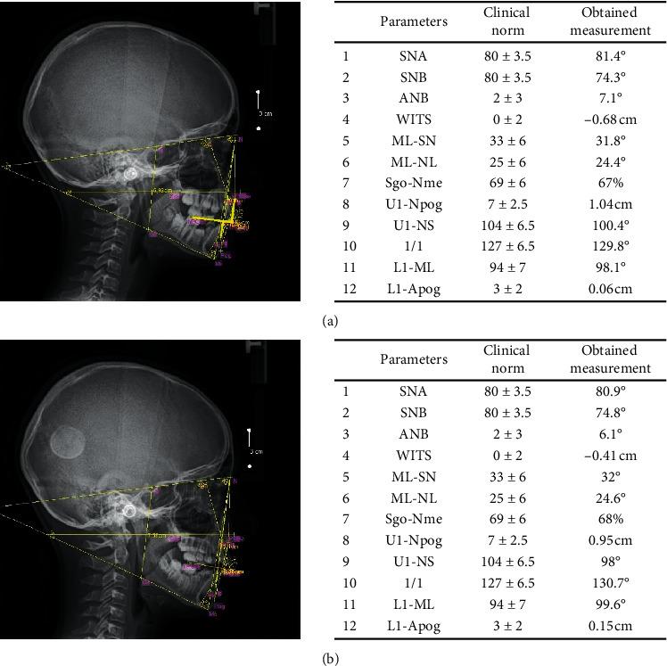 https://cdn.ncbi.nlm.nih.gov/pmc/blobs/8876/7568775/21f68c2b5cf2/JHE2020-8887182.001.jpg