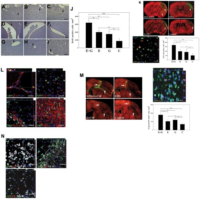 https://cdn.ncbi.nlm.nih.gov/pmc/blobs/8878/2852409/ac2892f9eebd/pone.0010093.g005.jpg