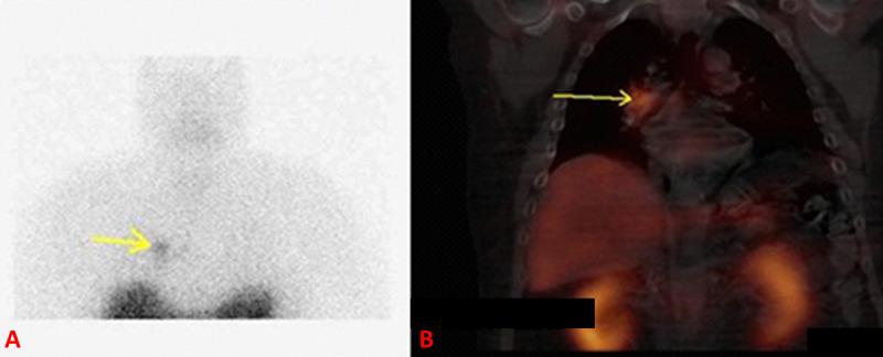 https://cdn.ncbi.nlm.nih.gov/pmc/blobs/8878/7769800/d642d9f003f7/cureus-0012-00000011704-i02.jpg