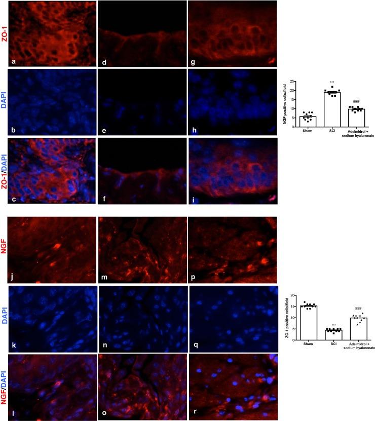 https://cdn.ncbi.nlm.nih.gov/pmc/blobs/887b/6336272/535c65c0d232/pone.0208730.g008.jpg
