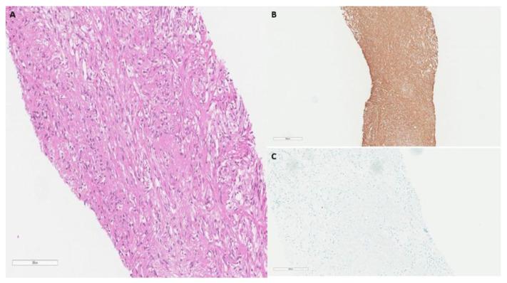 https://cdn.ncbi.nlm.nih.gov/pmc/blobs/8881/9139586/2bda109ef33e/curroncol-29-00240-g002.jpg