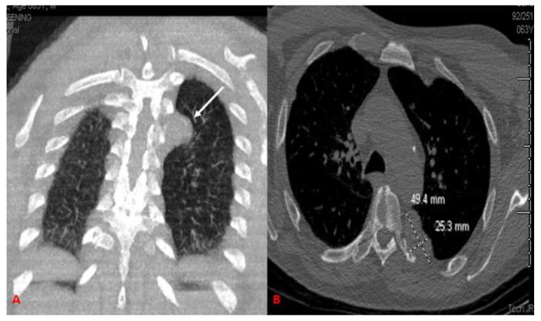 https://cdn.ncbi.nlm.nih.gov/pmc/blobs/8881/9139586/fa5c372f8288/curroncol-29-00240-g001.jpg