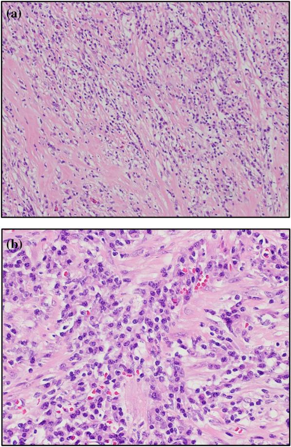 https://cdn.ncbi.nlm.nih.gov/pmc/blobs/888b/10616023/203160ab835f/40792_2023_1767_Fig4_HTML.jpg