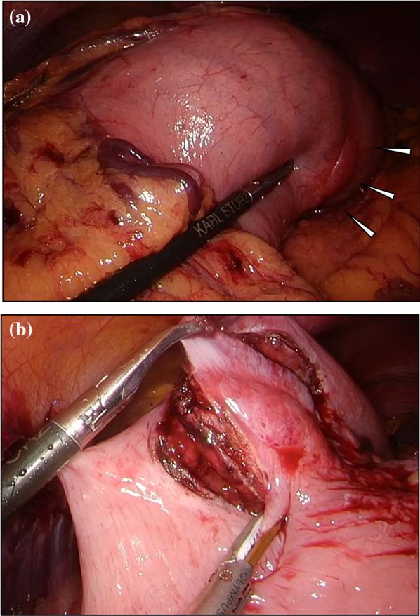 https://cdn.ncbi.nlm.nih.gov/pmc/blobs/888b/10616023/4370c726cbfb/40792_2023_1767_Fig2_HTML.jpg