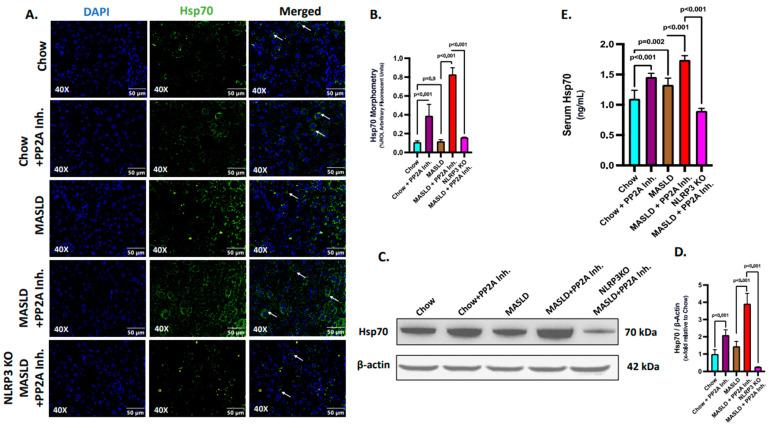 https://cdn.ncbi.nlm.nih.gov/pmc/blobs/888e/10671242/41cf5943415e/ijms-24-16354-g003.jpg
