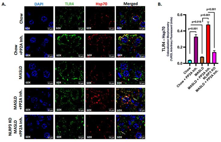 https://cdn.ncbi.nlm.nih.gov/pmc/blobs/888e/10671242/f9fb1052ffda/ijms-24-16354-g004.jpg