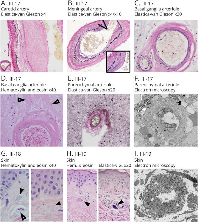 https://cdn.ncbi.nlm.nih.gov/pmc/blobs/888e/7958314/27734171788b/NG2020014639f3.jpg
