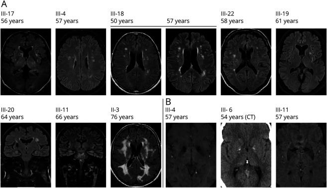 https://cdn.ncbi.nlm.nih.gov/pmc/blobs/888e/7958314/c66ab05d0fba/NG2020014639f2.jpg