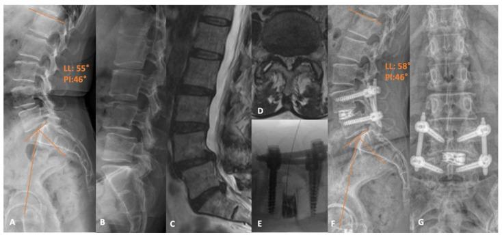 https://cdn.ncbi.nlm.nih.gov/pmc/blobs/8893/11051479/5ae191434abe/jcm-13-02271-g003.jpg