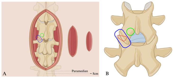 https://cdn.ncbi.nlm.nih.gov/pmc/blobs/8893/11051479/8782eaf5567d/jcm-13-02271-g002.jpg