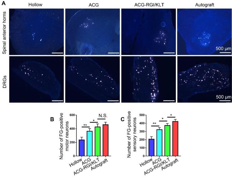 https://cdn.ncbi.nlm.nih.gov/pmc/blobs/8897/6993237/708a14d4fa1b/thnov10p1590g005.jpg