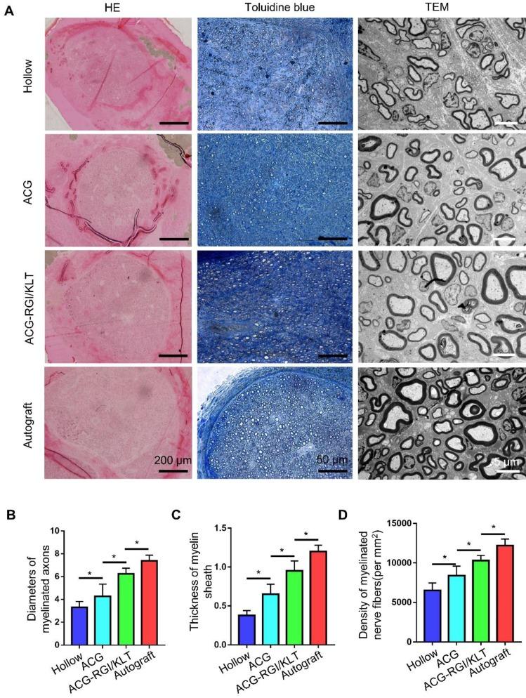https://cdn.ncbi.nlm.nih.gov/pmc/blobs/8897/6993237/7993ec4e83ff/thnov10p1590g004.jpg