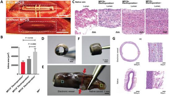 https://cdn.ncbi.nlm.nih.gov/pmc/blobs/88a3/11912110/482c9187d6f0/ADHM-14-0-g004.jpg