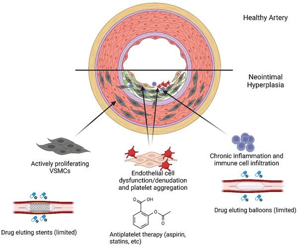 https://cdn.ncbi.nlm.nih.gov/pmc/blobs/88a3/11912110/b4e1f82b1789/ADHM-14-0-g006.jpg