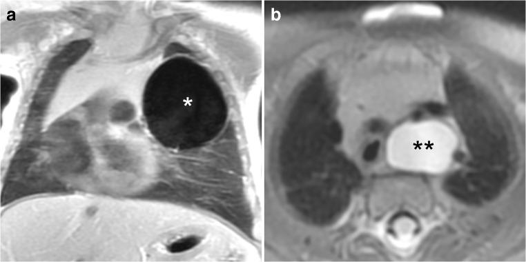 https://cdn.ncbi.nlm.nih.gov/pmc/blobs/88b5/7329781/2e226a0f0aec/247_2020_4658_Fig2_HTML.jpg