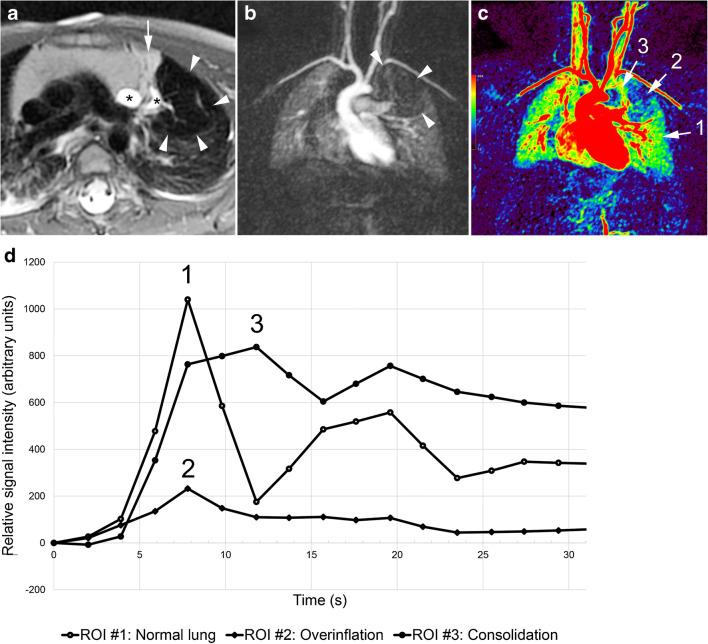 https://cdn.ncbi.nlm.nih.gov/pmc/blobs/88b5/7329781/485fb7821490/247_2020_4658_Fig4_HTML.jpg