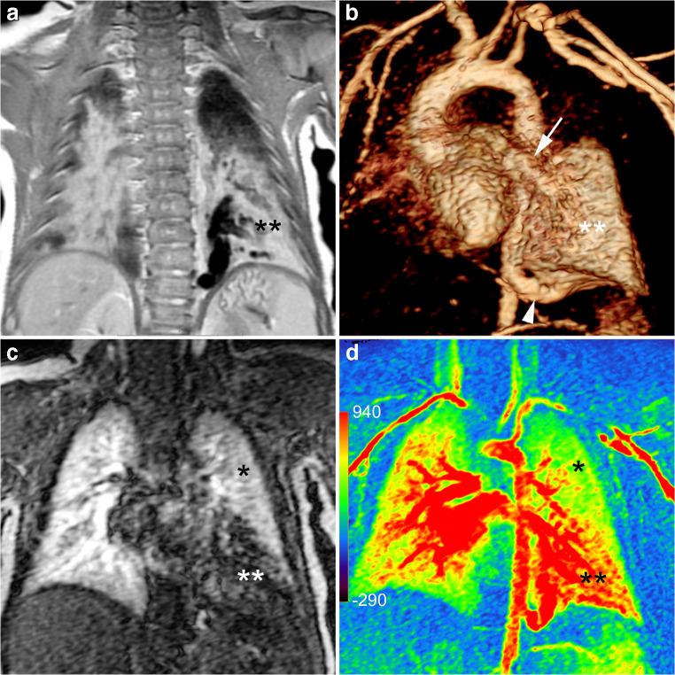 https://cdn.ncbi.nlm.nih.gov/pmc/blobs/88b5/7329781/c83a1cf247df/247_2020_4658_Fig5_HTML.jpg