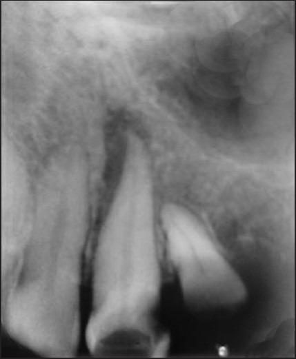 https://cdn.ncbi.nlm.nih.gov/pmc/blobs/88bb/4001280/66dee28efc5d/JCD-17-188-g003.jpg