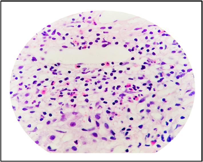https://cdn.ncbi.nlm.nih.gov/pmc/blobs/88bc/8941177/6834c5199abc/gr2.jpg