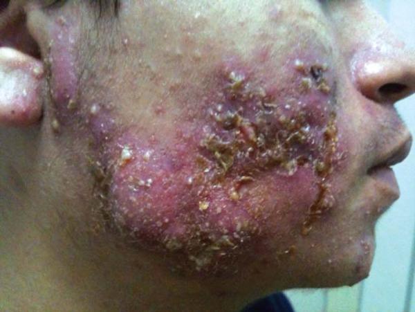 https://cdn.ncbi.nlm.nih.gov/pmc/blobs/88bf/3875980/10286453f404/abd-88-06-s1-0193-g01.jpg