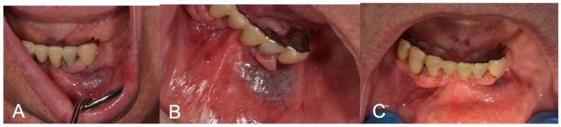 https://cdn.ncbi.nlm.nih.gov/pmc/blobs/88c0/11122876/221a922a3f17/medicina-60-00822-g002.jpg