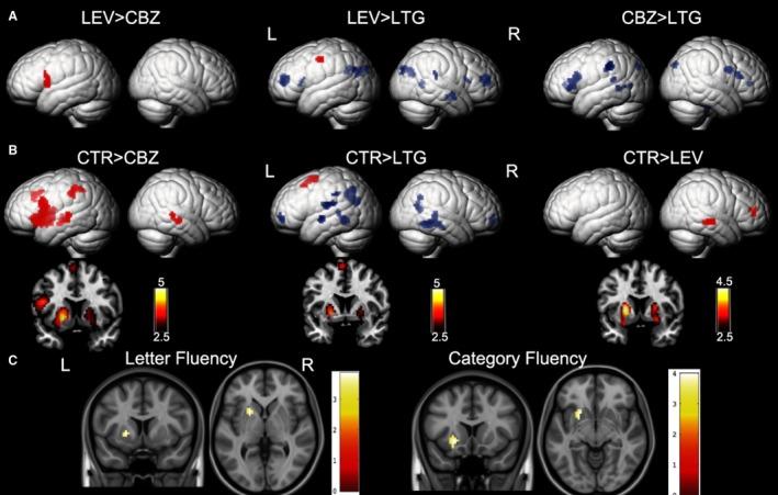 https://cdn.ncbi.nlm.nih.gov/pmc/blobs/88c2/6216427/d5dddaa81461/EPI-59-1362-g002.jpg