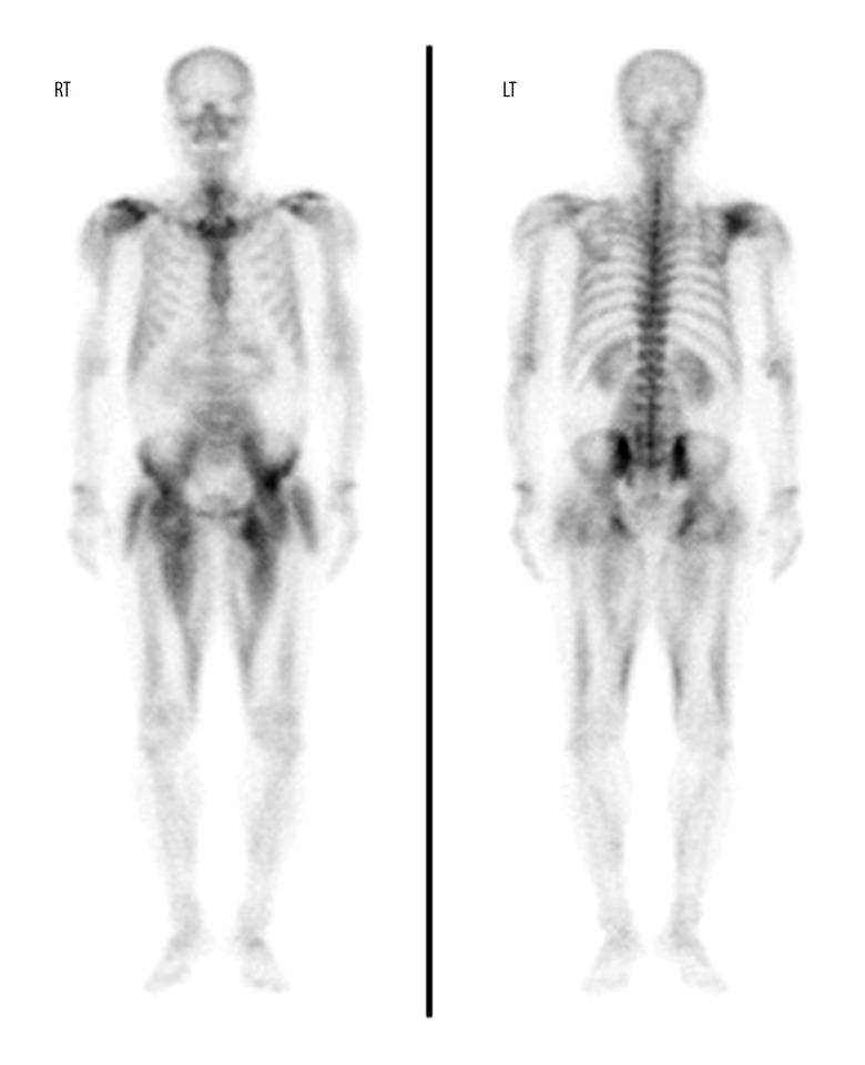 https://cdn.ncbi.nlm.nih.gov/pmc/blobs/88d2/9190773/210262715d14/amjcaserep-23-e936407-g002.jpg