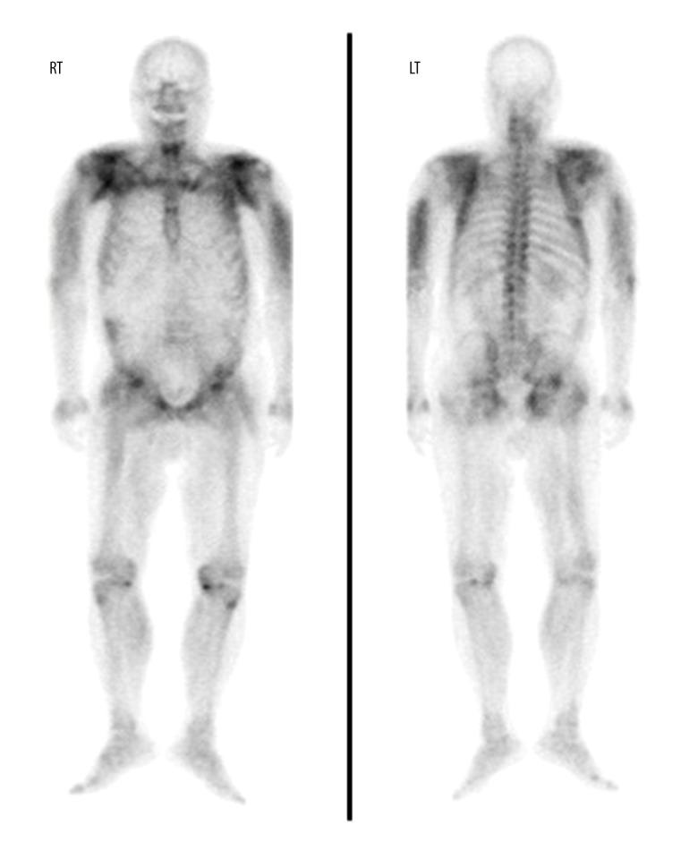 https://cdn.ncbi.nlm.nih.gov/pmc/blobs/88d2/9190773/717977e3d8f3/amjcaserep-23-e936407-g001.jpg
