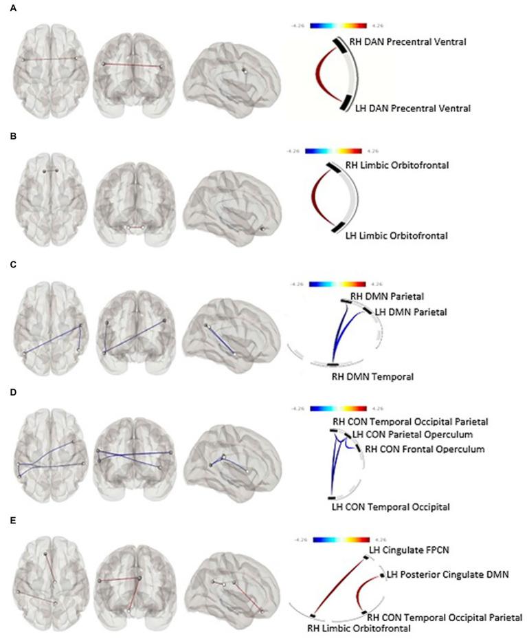 https://cdn.ncbi.nlm.nih.gov/pmc/blobs/88d7/10230054/2ba669136df3/fpsyt-14-1102368-g001.jpg
