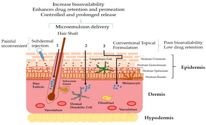 https://cdn.ncbi.nlm.nih.gov/pmc/blobs/88e3/10222322/39718a7283c3/nanomaterials-13-01688-g006.jpg
