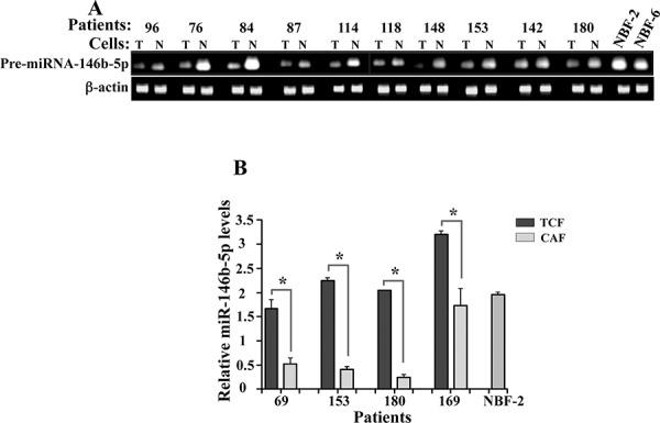 https://cdn.ncbi.nlm.nih.gov/pmc/blobs/88e3/4745778/1c34d6412d08/oncotarget-06-30006-g005.jpg