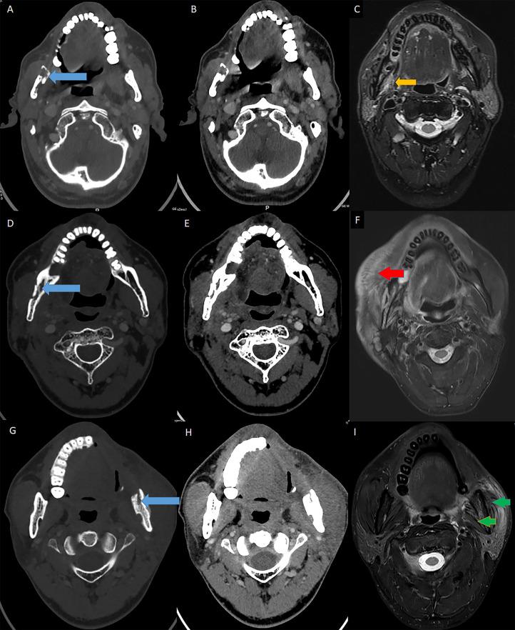 https://cdn.ncbi.nlm.nih.gov/pmc/blobs/88e7/8113699/85e5aea03c0a/fonc-11-641061-g003.jpg