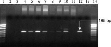 https://cdn.ncbi.nlm.nih.gov/pmc/blobs/88e8/7112630/dc17d6824de6/gr1.jpg