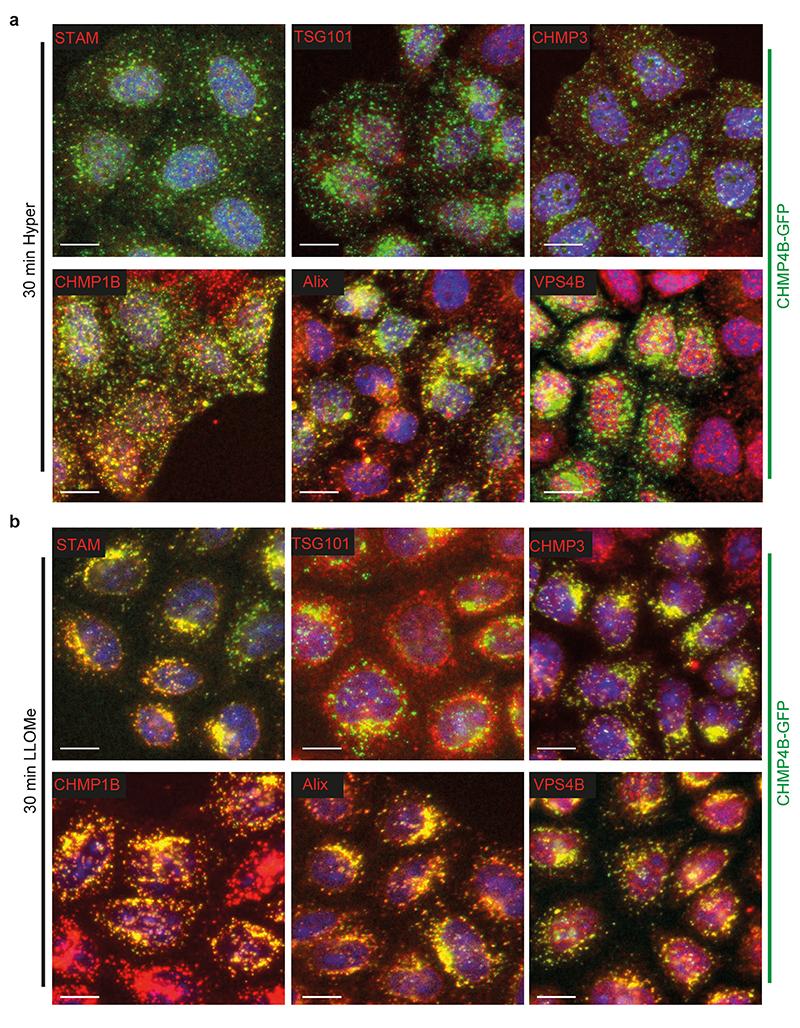 https://cdn.ncbi.nlm.nih.gov/pmc/blobs/88ee/7612185/aa0b18983620/EMS118425-f010.jpg