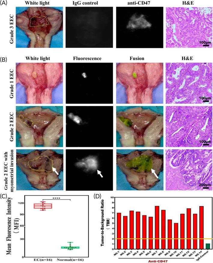 https://cdn.ncbi.nlm.nih.gov/pmc/blobs/88f2/12079536/b4006c22332b/BTM2-10-e10754-g007.jpg