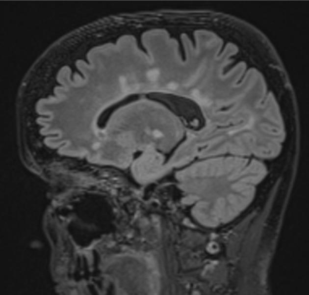 https://cdn.ncbi.nlm.nih.gov/pmc/blobs/88f4/10867947/99693b6ff277/PJR-88-52041-g001.jpg