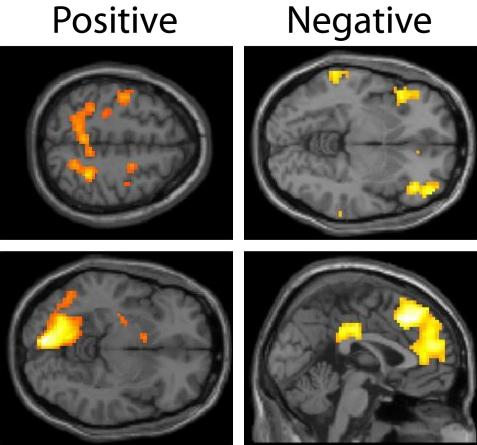 https://cdn.ncbi.nlm.nih.gov/pmc/blobs/88fa/2987510/9a9b25aba3c7/fnins-04-00176-g004.jpg