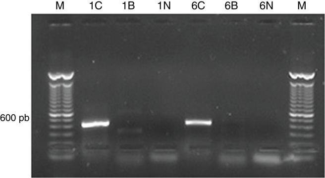 https://cdn.ncbi.nlm.nih.gov/pmc/blobs/88fe/5993878/88fc5af26d7f/gr1.jpg