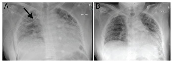 https://cdn.ncbi.nlm.nih.gov/pmc/blobs/88ff/8631211/d923d672efe7/squmj2111-660-663f3.jpg