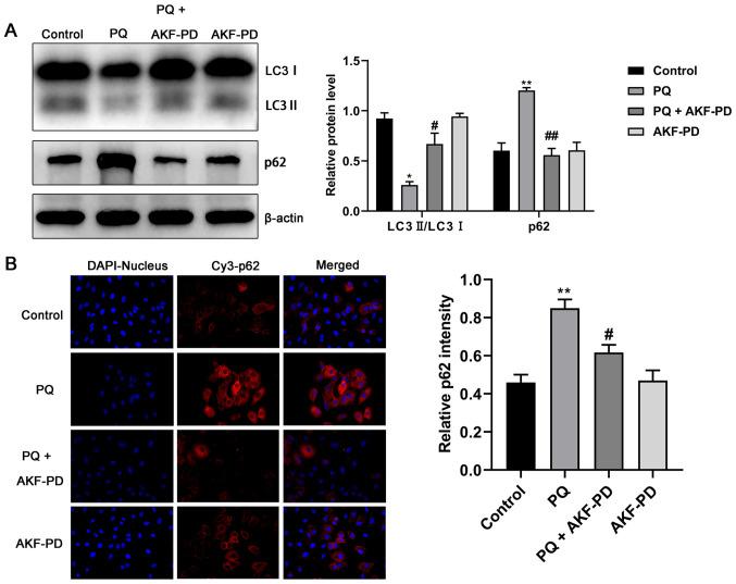 https://cdn.ncbi.nlm.nih.gov/pmc/blobs/8900/8025463/6fa9ca5f866d/mmr-23-06-12044-g06.jpg